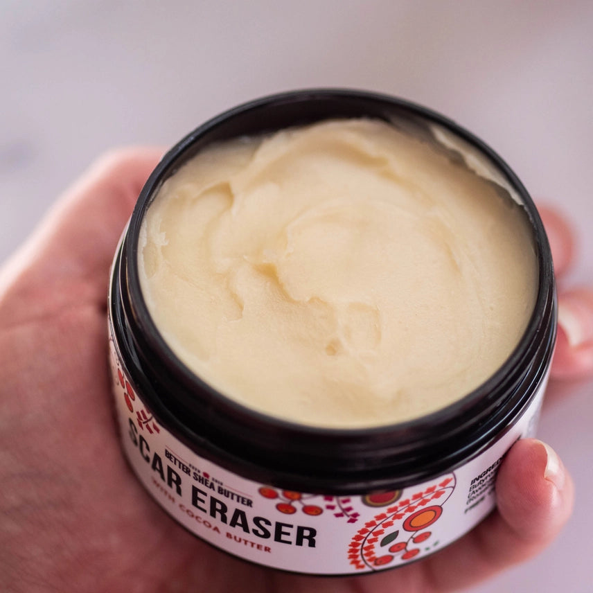 Scar Eraser - Scar & Stretch Marks Cream