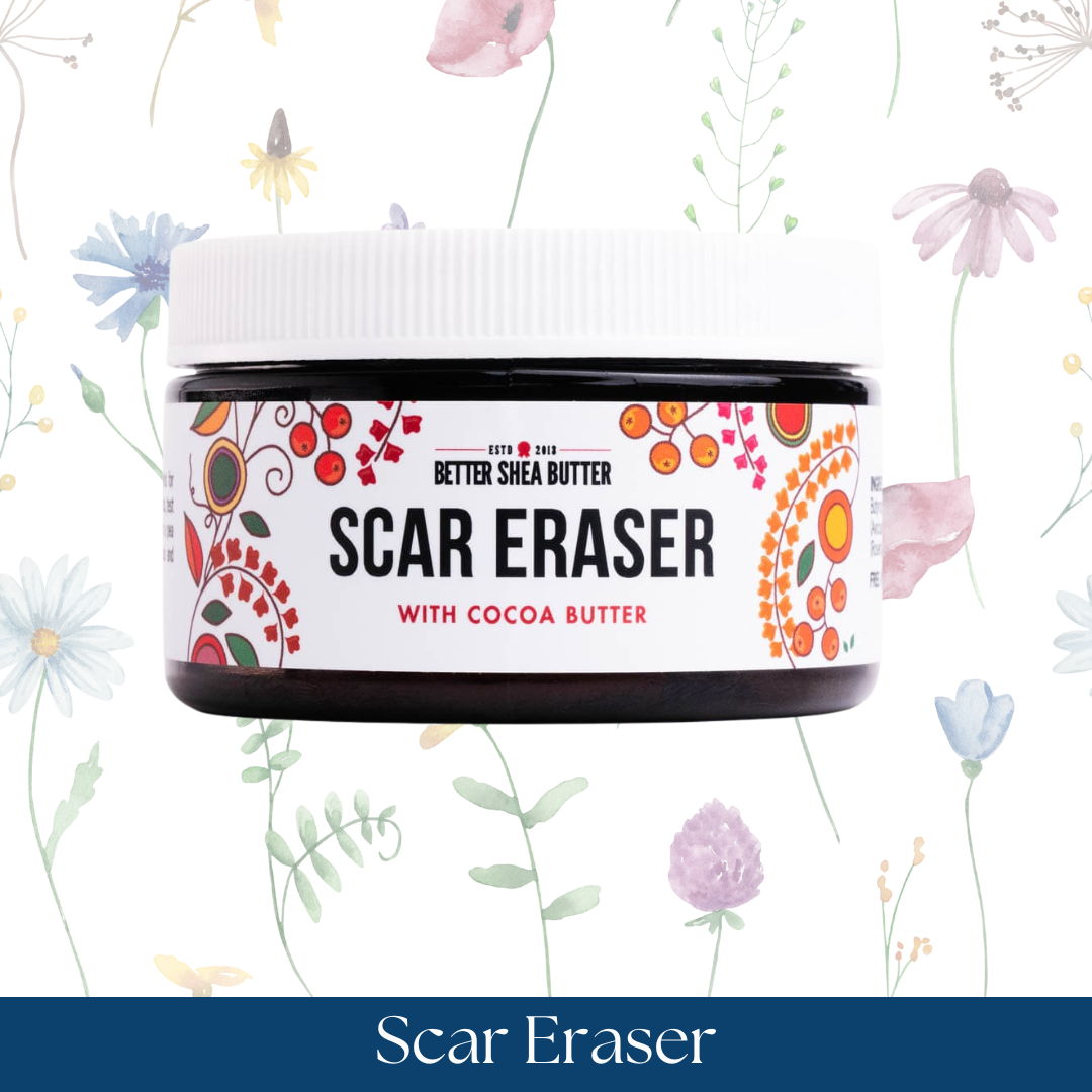 Scar Eraser - Scar & Stretch Marks Cream